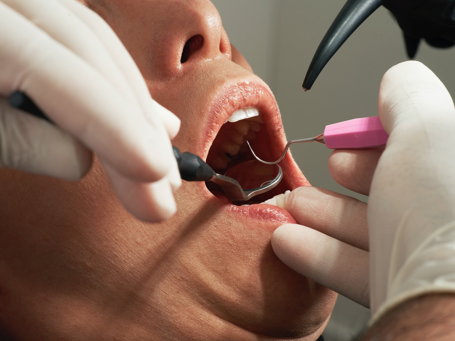 A person receiving an oral cancer screening at Shifa Dentistry in Ottawa.